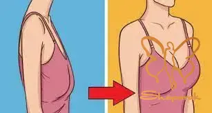 ماکروفت Macrofat حجم دهی به باسن و سینه بازسازی عمیق گونه ها در مشهد