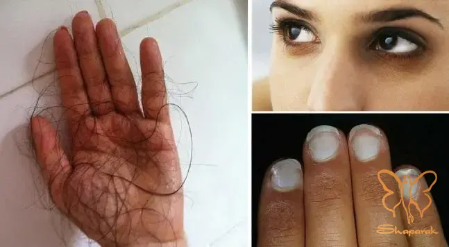  کلینیک تخصصی لیزر موهای زائد شاپرک طلایی مشهد