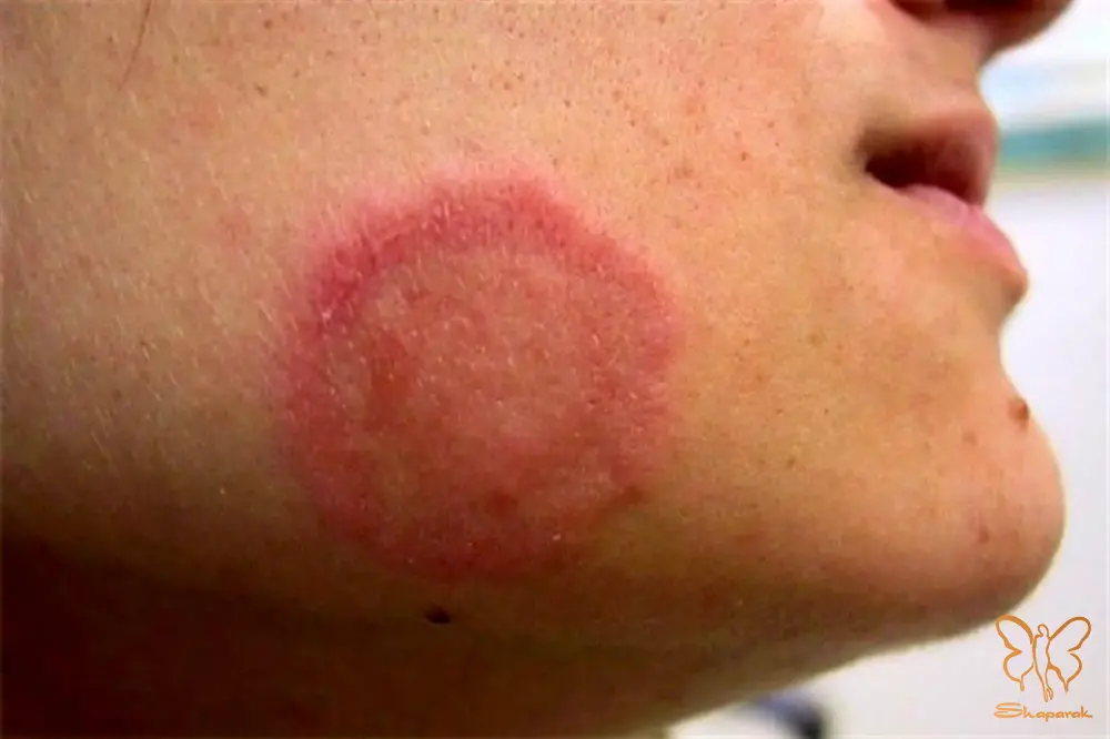 چه کسانی بیشتر در معرض خطر هستند