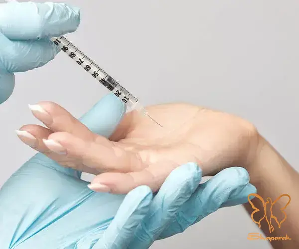 بوتاکس ضد تعریق چگونه عمل میکند