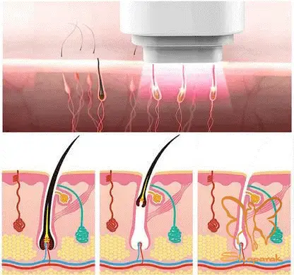 الکساندرایت موتوس در مشهد Motus الکساندرایت موتوس در مشهد Motus