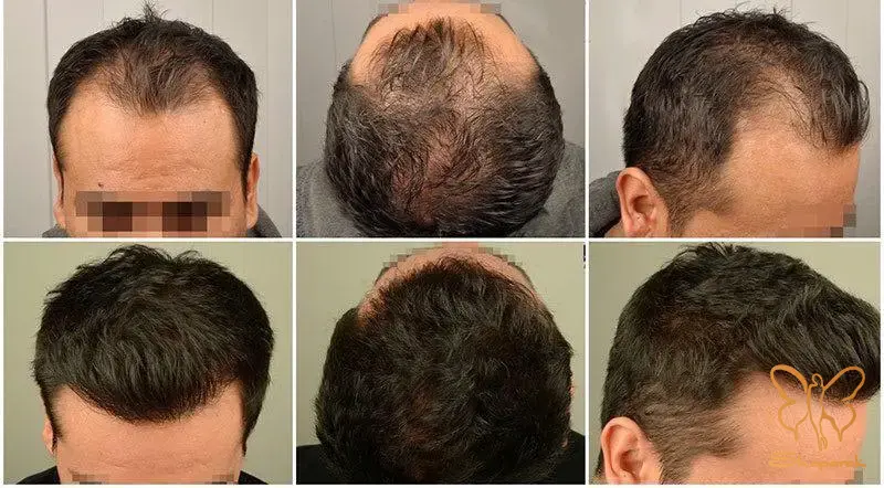 دستگاه های پیشرفته جوانسازی پوست و مو