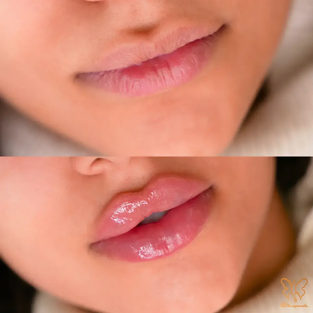 مشاوره صادقانه با پزشک