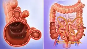 اشعه ماوراء بنفش UV&nbsp;خورشید