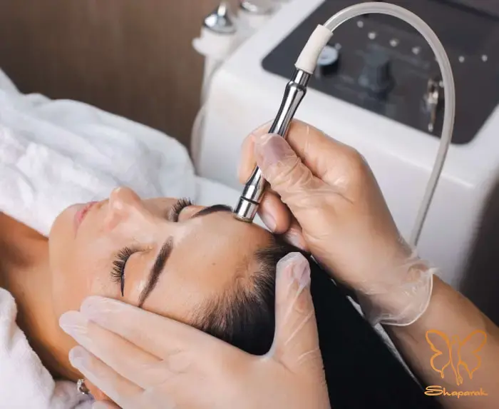 مراحل انجام میکرودرم ابریژن در کلینیک شاپرک طلایی مشهد
