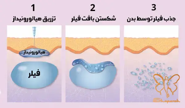 هیالورونیک اسید 