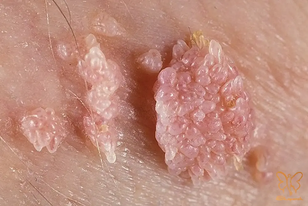 کلینیک تخصصی پوست و مو شاپرک طلایی مشهد کلینیک تخصصی پوست و مو شاپرک طلایی مشهد