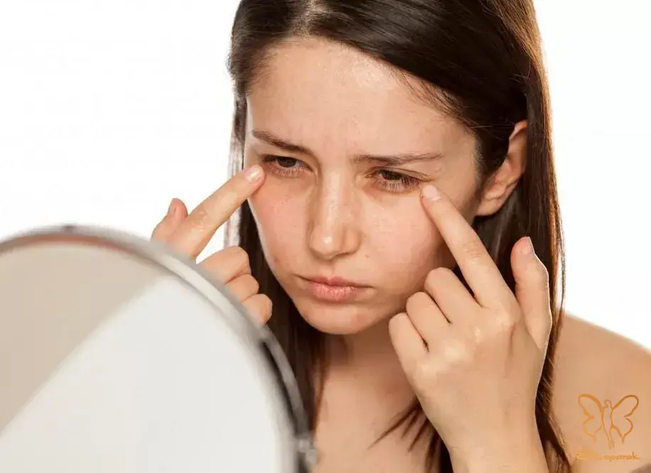 نقش تغذیه و محیط در سلامت پوست ایرانیان نقش تغذیه و محیط در سلامت پوست ایرانیان