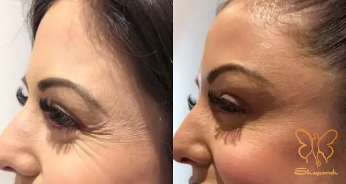 پدیده تیندال پدیده تیندال