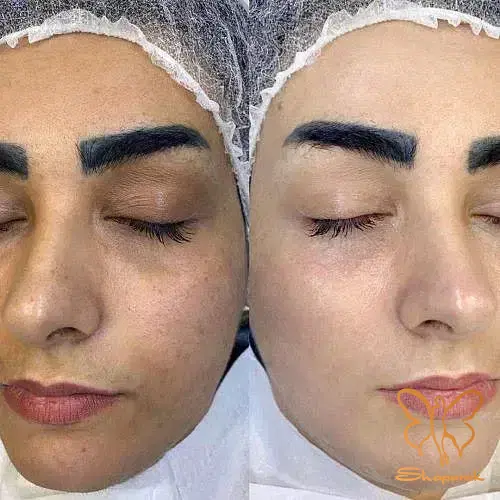 دستگاه های جوانسازی مشهد دستگاه های جوانسازی مشهد