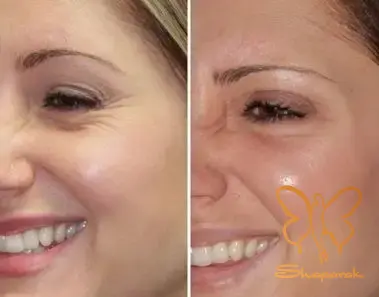 کرم ضدآفتاب کرم ضدآفتاب