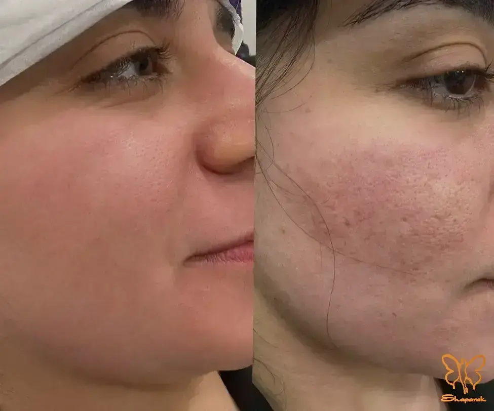  کلینیک تخصصی لیزر موهای زائد شاپرک طلایی مشهد