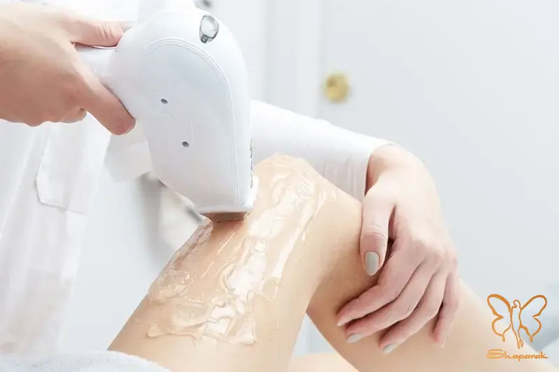 نکات مهم هنگام انتخاب مرکز لیزر مو زائد در مشهد نکات مهم هنگام انتخاب مرکز لیزر مو زائد در مشهد