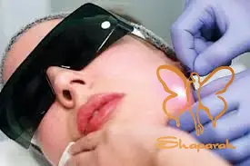 اندولیفت یک روش درمانی کمتهاجمی