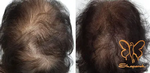 توبولین توبولین