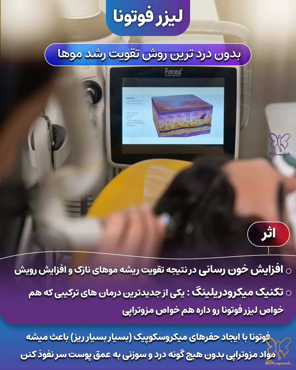 احیای مو احیای مو