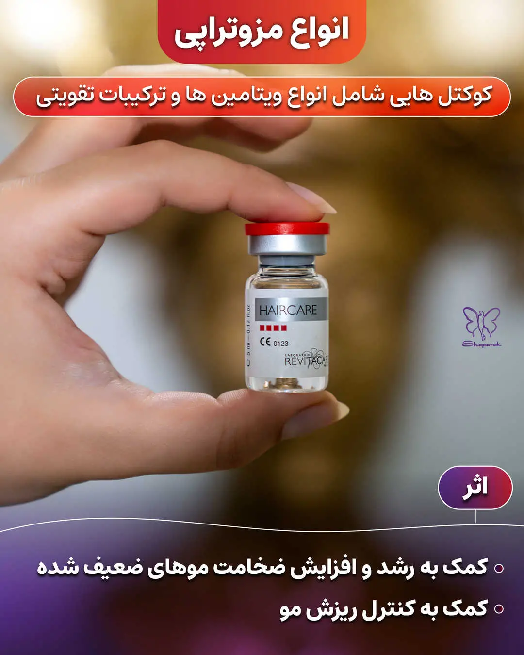 مزوتراپی مو