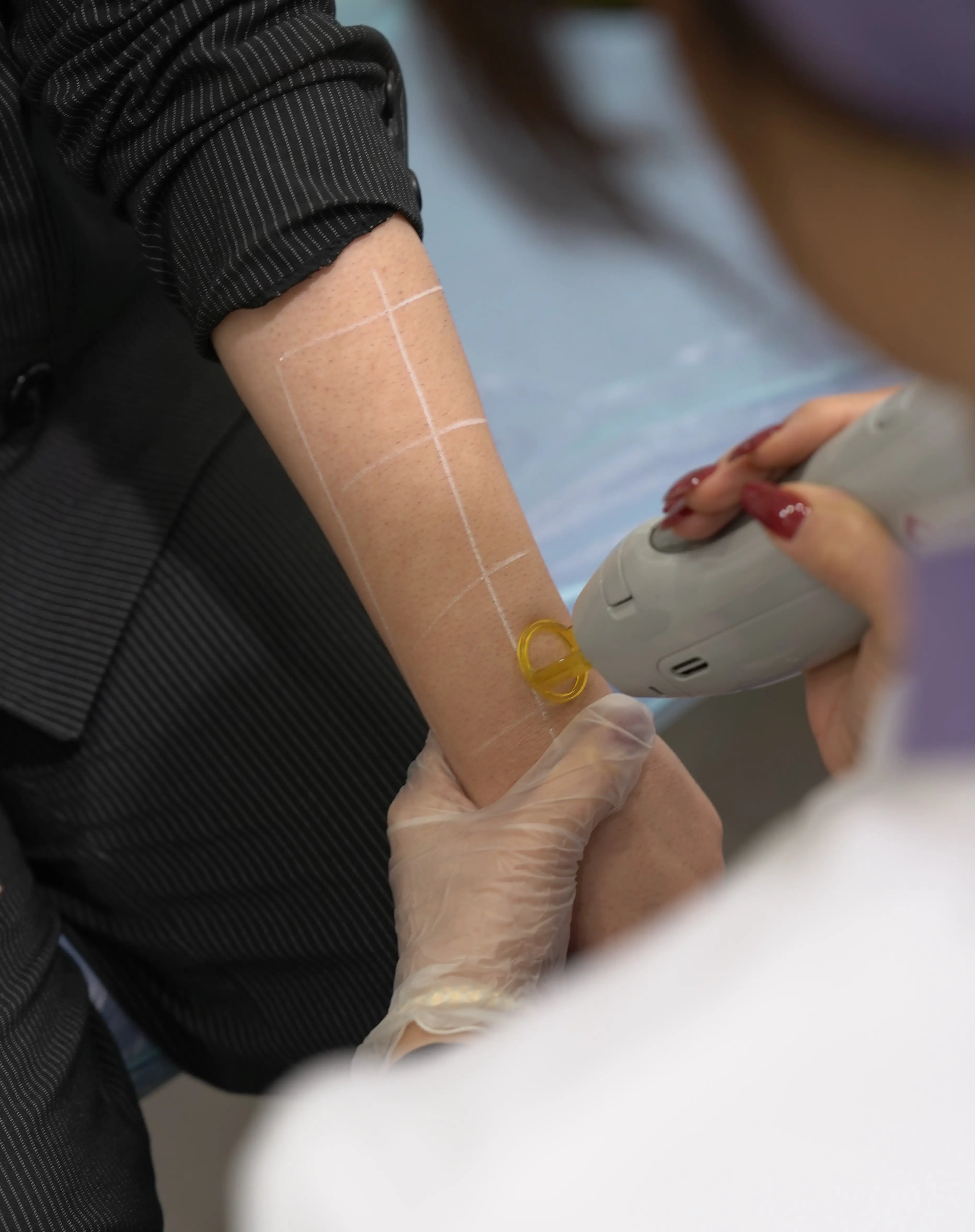 تجربه پوستی صاف و بدون مو با تکنولوژی لیزر روز دنیا در مشهد