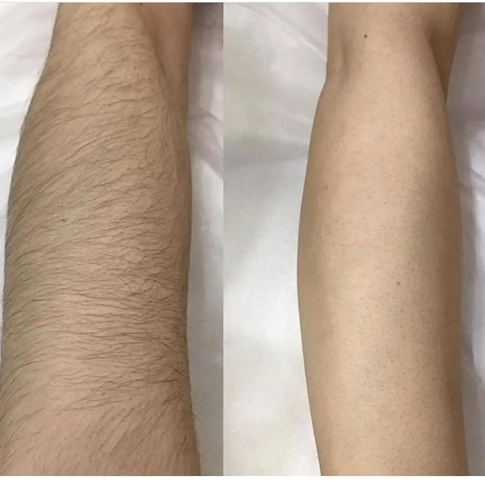 کلینیک تخصصی لیزر موهای زائد شاپرک طلایی مشهد کلینیک تخصصی لیزر موهای زائد شاپرک طلایی مشهد