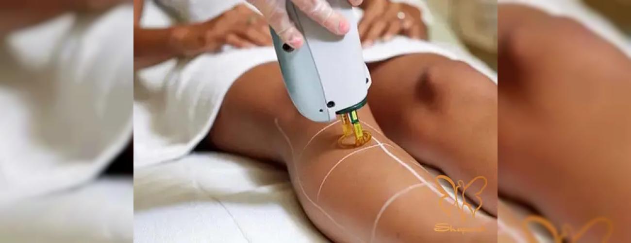 تاریخچه دستگاه لیزر موهای زائد: لیزر با موهای بدن شما دقیقا چه میکند؟