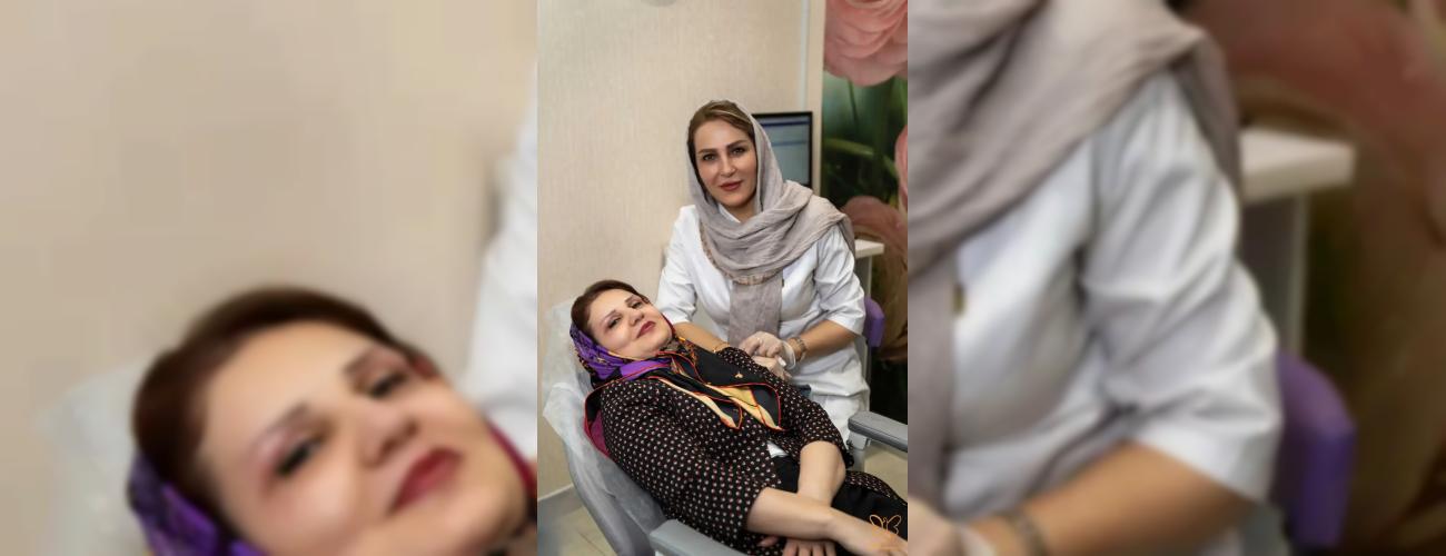 بلفاروپلاستی پلک بالا در مشهد