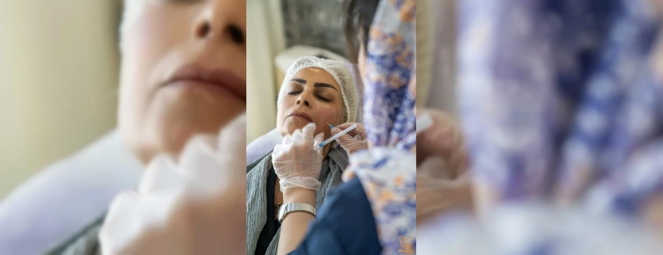 تحول چهره تا عید نوروز: تضمین تغییر فوق‌العاده با روشهای زیبایی شاپرک طلایی مشهد