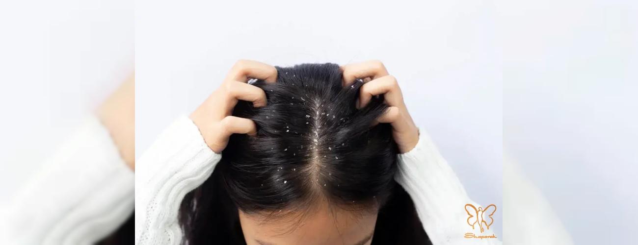 خدمات زیبایی با عفونت‌ های قارچی پوست و مو مشهد 