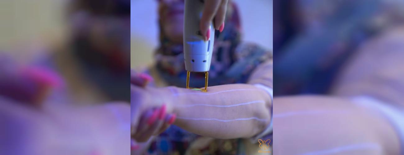 ریسک نکنید! لیزر موهای زائد فقط با نظارت پزشک و اپراتور حرفه‌ای