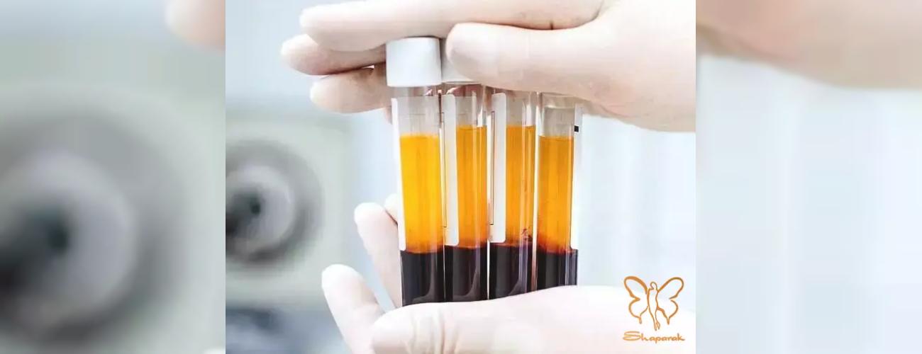 گام به گام پی آر پی مو در کلینیک تخصصی پوست و مو شاپرک طلایی مشهد 