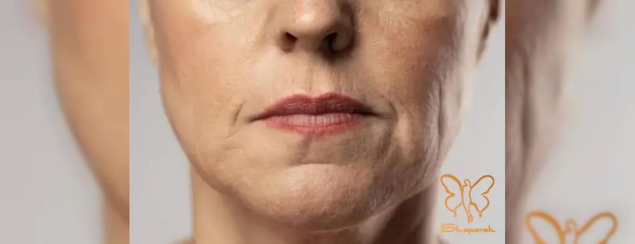 مراقبت های بعد از خدمات زیبایی با دستگاه های پیشرفته در کلینیک شاپرک مشهد 