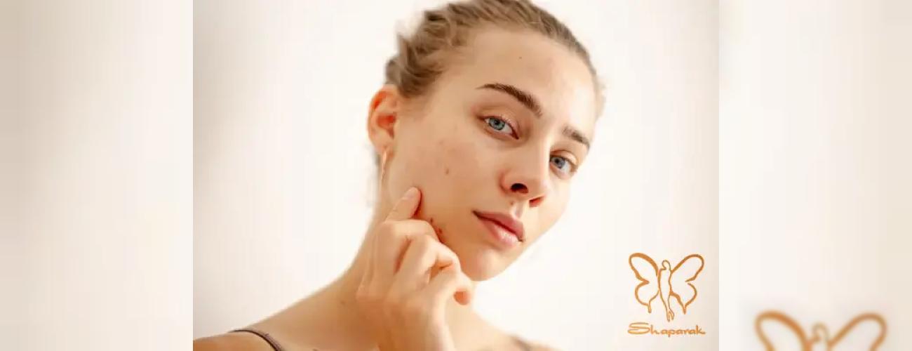 جوش ندول چیست و چگونه برای همیشه از شر آن خلاص شویم؟