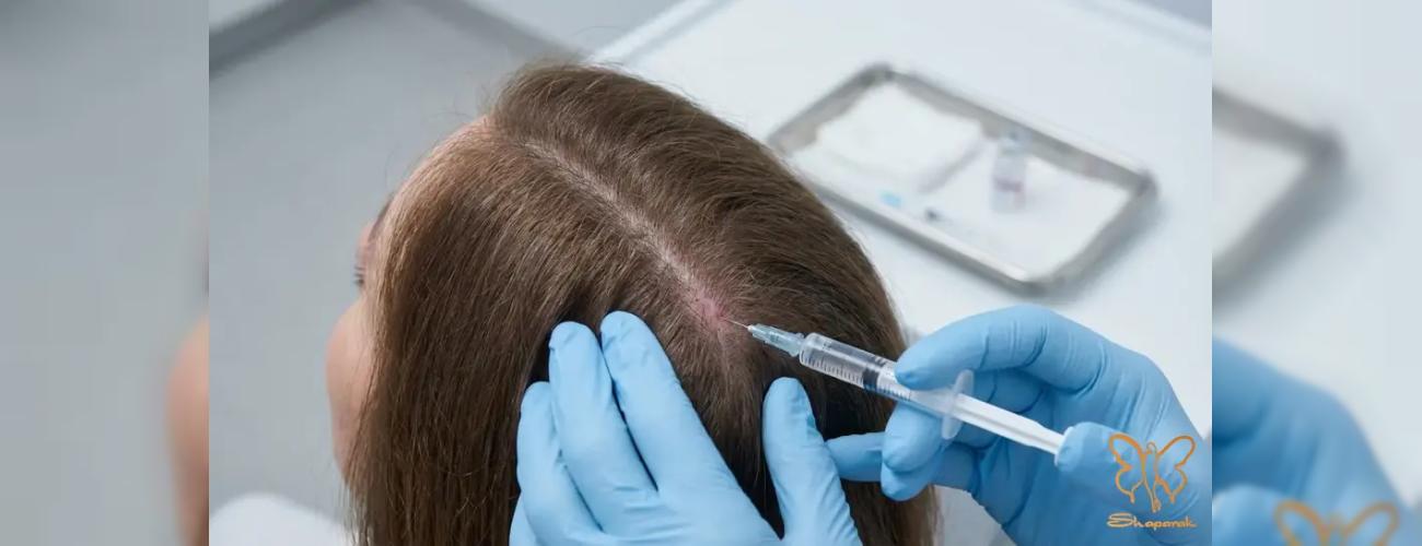 مکانیزم دقیق مزوتراپی: از مواد تشکیل‌دهنده تا توقف کامل ریزش مو
