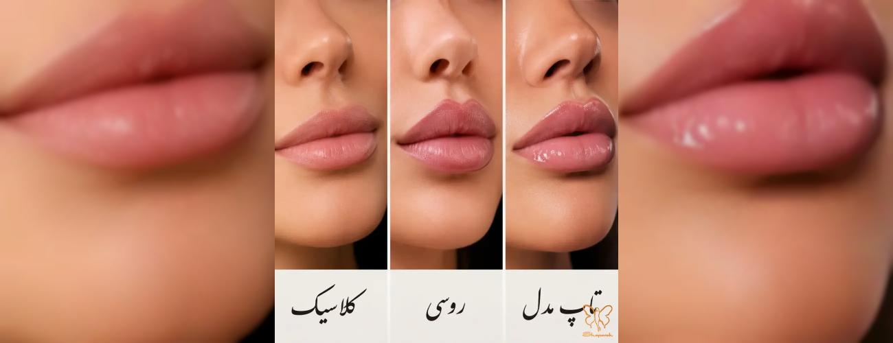 کدام مدل ژل لب به صورت من می‌آید؟ (مقایسه مدل روسی، نچرال و تاپ مدل) در شاپرک مشهد