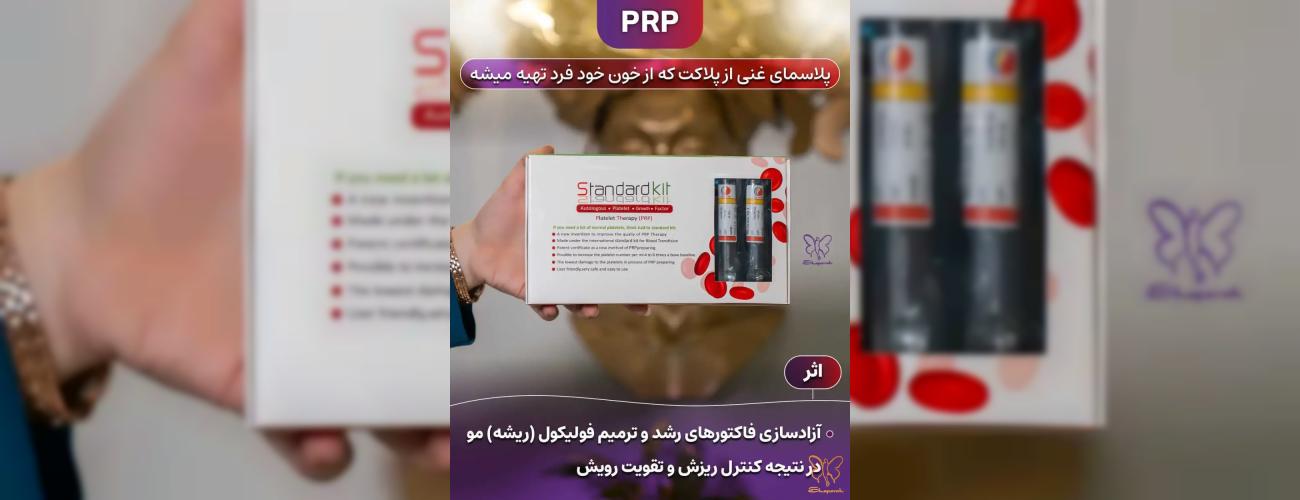 درمان قطعی ریزش مو با تزریق پی آر پی در کلینیک شاپرک طلایی مشهد 