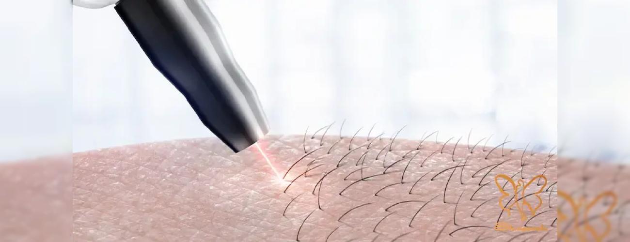 تاریخچه دستگاه لیزر موهای زائد: لیزر با موهای بدن شما دقیقا چه میکند؟