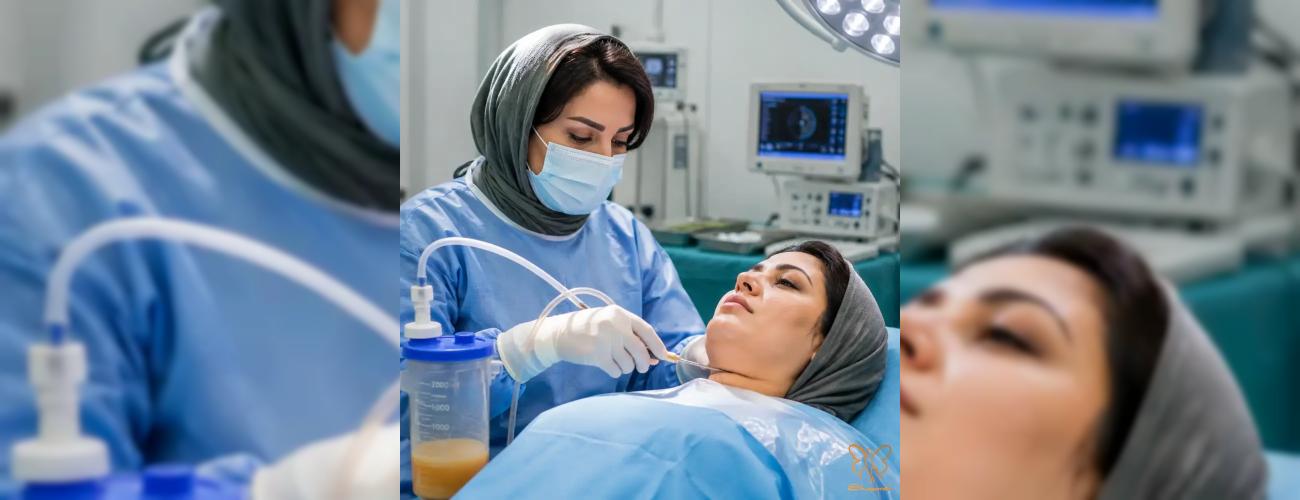 ساکشن غبغب در مشهد: آیا نتایج این درمان بازگشت‌پذیر است؟ 