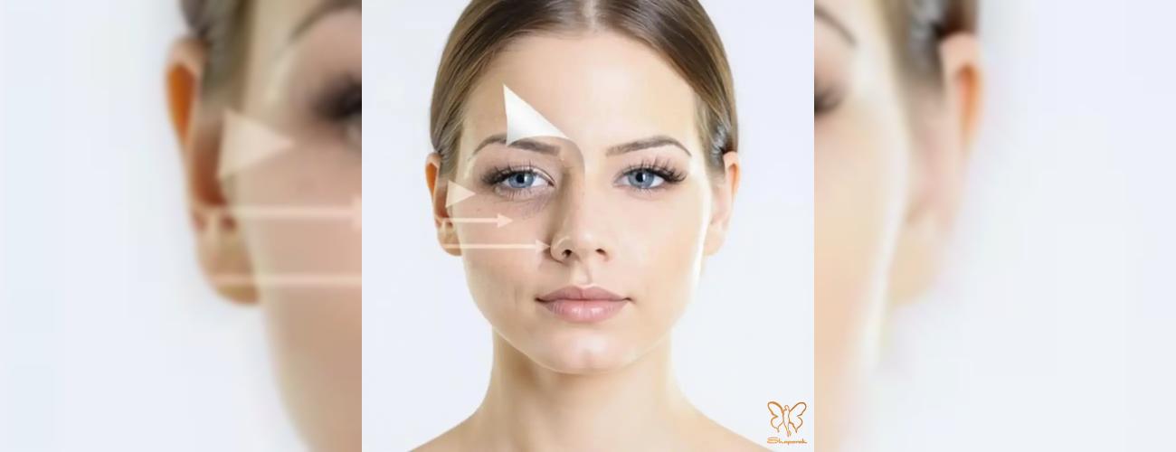 PRF یا مزوژل یانگ ای؟ | بهترین راهکار برای درمان چروک و سیاهی دور چشم در مشهد