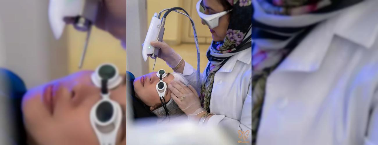 سوالات پرتکرار لیزر فوتونا در مشهد: از کاربردها و قیمت تا عوارض جانبی