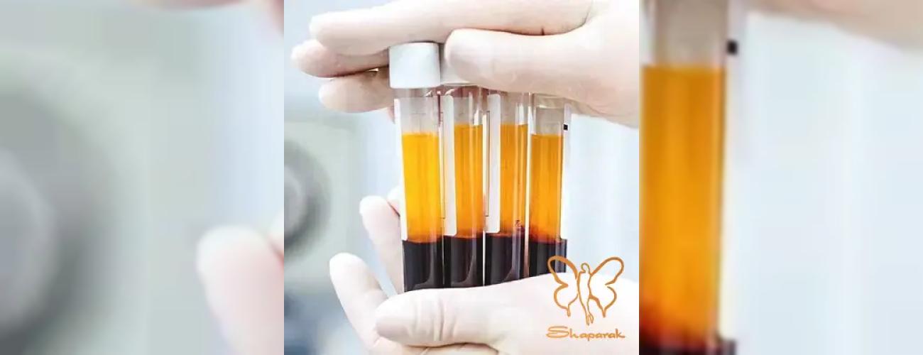 مزایای متعدد PRP مو در کلینیک تخصصی پوست و مو شاپرک طلایی مشهد 