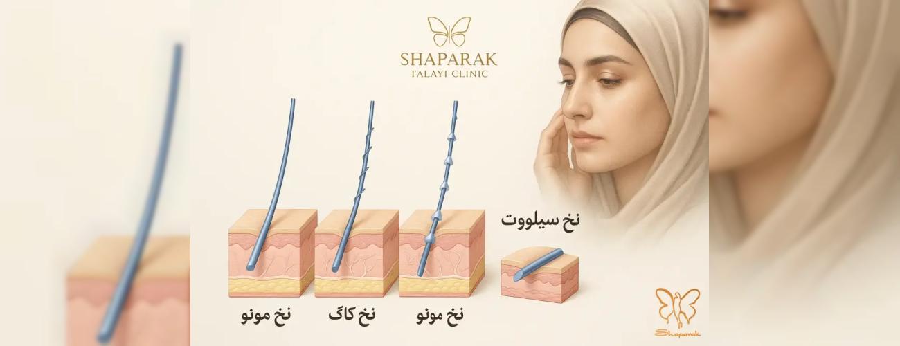 تفاوت انواع نخ ها ، PDO  ، کاگ ، سیلوئت ، اسکرو ، مونو