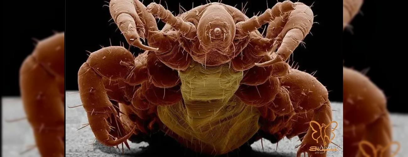 شپش یا کنه؟ تشخیص فوری مهمانان ناخوانده مو در کلینیک شاپرک مشهد