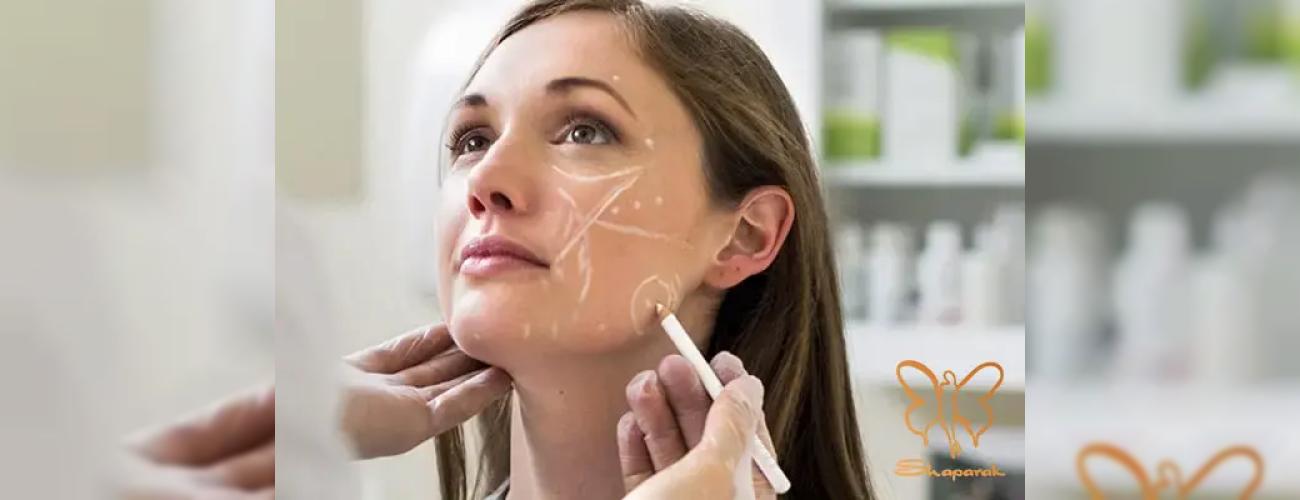 مقایسه 3 برند فیلر: مدلینگ صورت با تزریق ژل چانه در کلینیک شاپرک مشهد 
