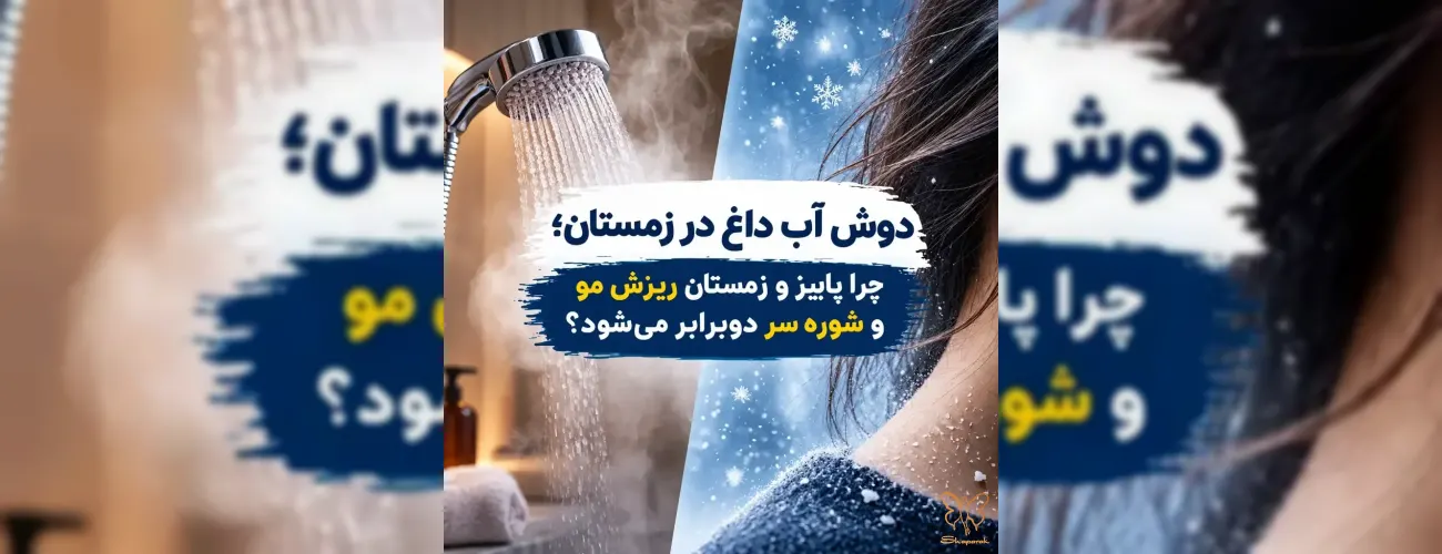 دوش آب داغ در زمستان، چرا پاییز و زمستان ریزش مو و شوره سر دوبرابر می‌شود؟