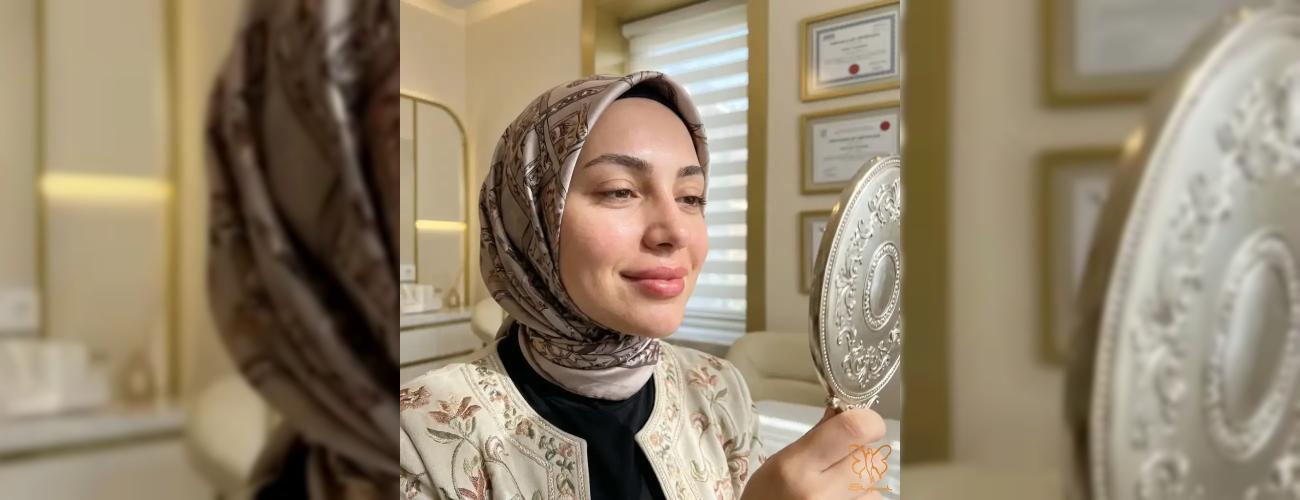 ژل ژوویدرم برای رفع تیرگی لب افراد سیگاری؛ بهبود رنگ لب با کلینیک شاپرک طلایی مشهد