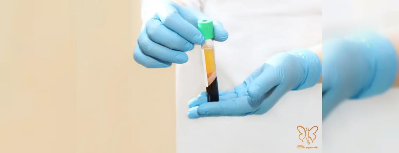 چرا کلینیک شاپرک طلایی را برای تزریق PRP ابرو انتخاب کنید؟ انتخاب برترین‌ها در مشهد!