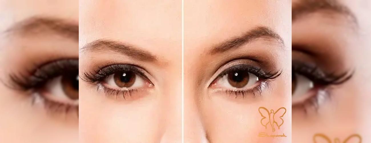 عوارض دایرکت دایرکت ابرو: از جای بخیه تا نتیجه نهایی | کلینیک شاپرک مشهد