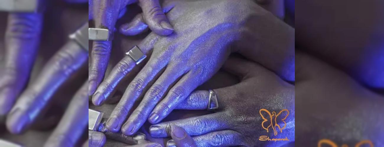 کلینیک شاپرک مشهد: آیا خدمات زیبایی برای بیماران آرگیریا ممکن است؟
