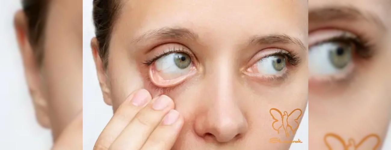 چگونه با جبران کمبود آهن، موهایی پرپشت و پوستی درخشان داشته باشیم؟