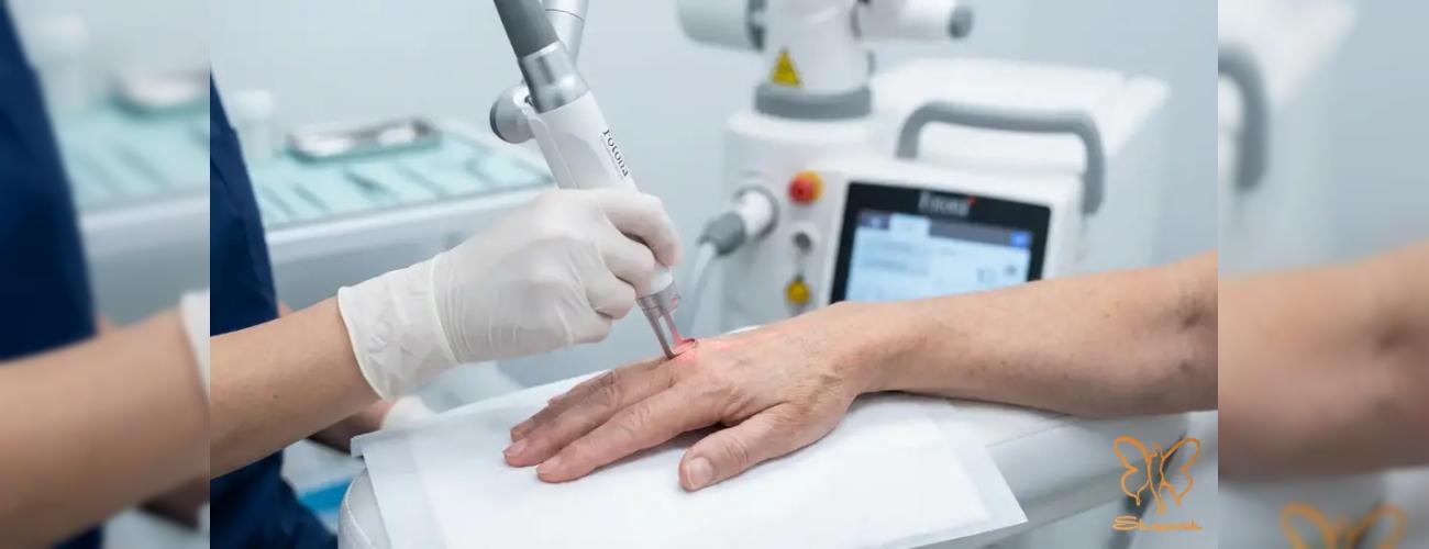 مقایسه جامع فوتونا و پیلینگ برای جوانسازی دست + معرفی تنها مرکز فوتونا در مشهد