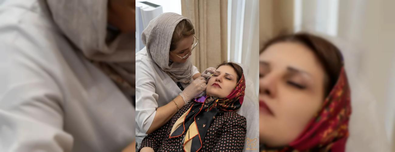 درمان تیرگی و چروک دور چشم با جالپرو یانگ آی در کلینیک شاپرک طلایی مشهد 
